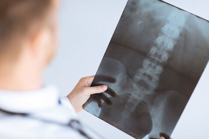 Diagnostikas iespējas jostas osteohondrozei