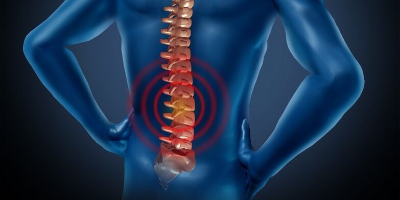 Jostas reģiona osteohondroze